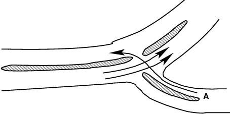 Channelization Arrows Channelization